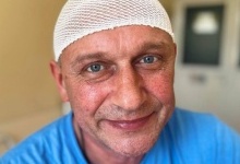 Нейрохірурги у Львові видалили чоловіку гігантську пухлину, яка завадила поїхати на фронт