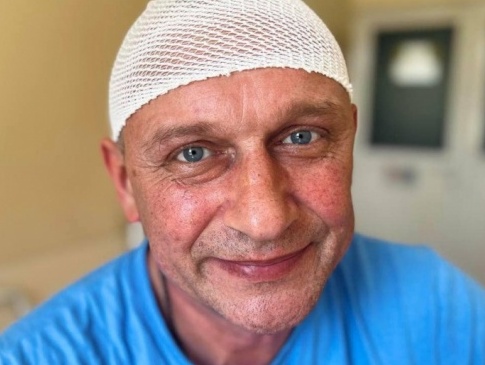 Нейрохірурги у Львові видалили чоловіку гігантську пухлину, яка завадила поїхати на фронт