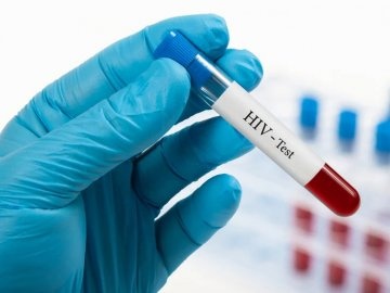 У Луцьку протягом одного дня безкоштовно робитимуть тестування на ВІЛ/СНІД та гепатит С