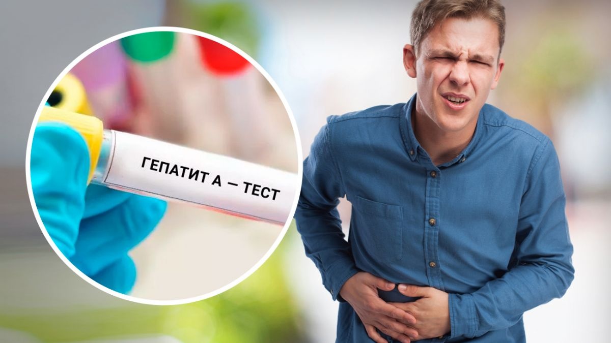 Україною шириться гепатит А. Як вберегтися?