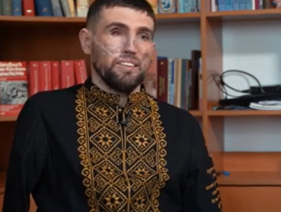 «Не можна лише надіятися, треба боротися», - поранений боєць ЗСУ Захар Бірюков про жагу до життя і боротьбу